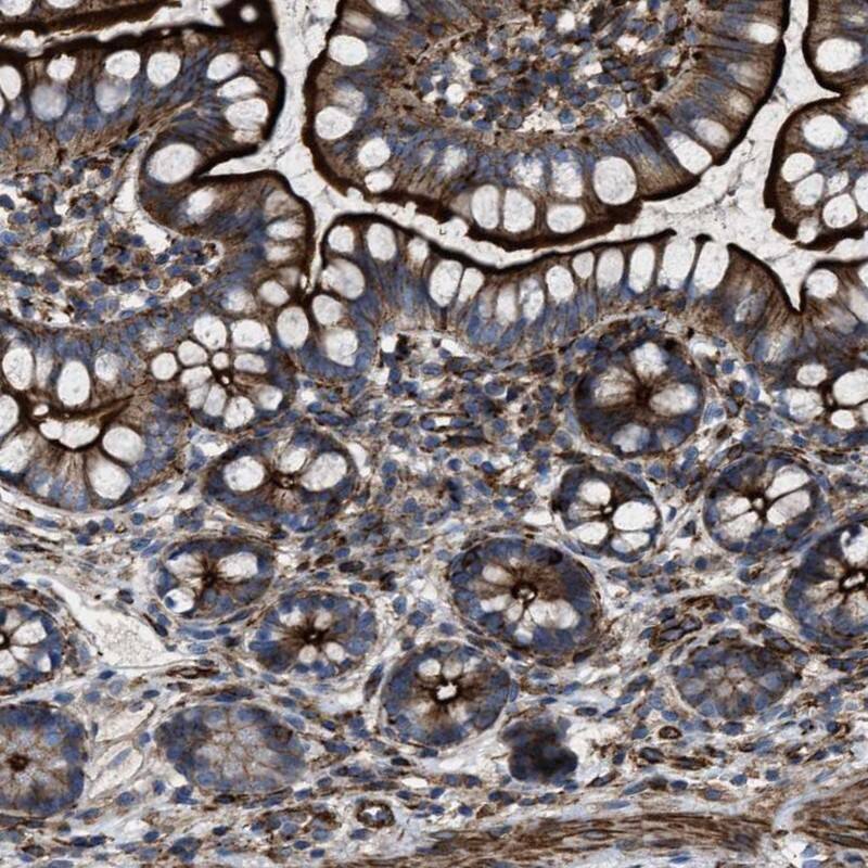 Immunohistochemistry-Paraffin AGPAT2 Antibody - BSA Free
