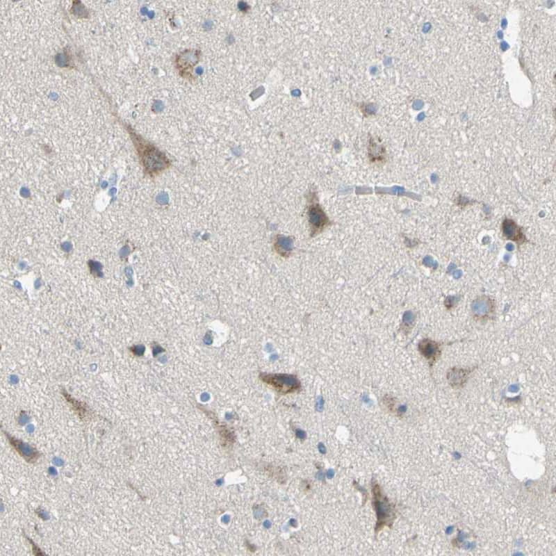 Staining of human cerebral cortex shows moderate cytoplasm granular positivity in neuronal cells.