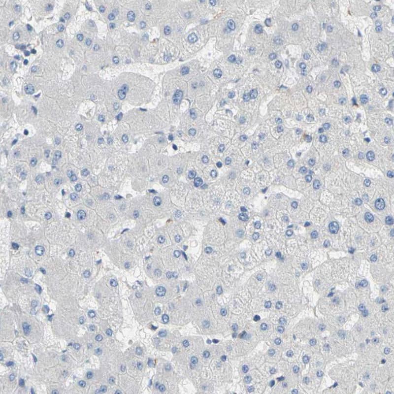 Staining of human liver shows no  cytoplasm granular  positivity in hepatocytes as expected.