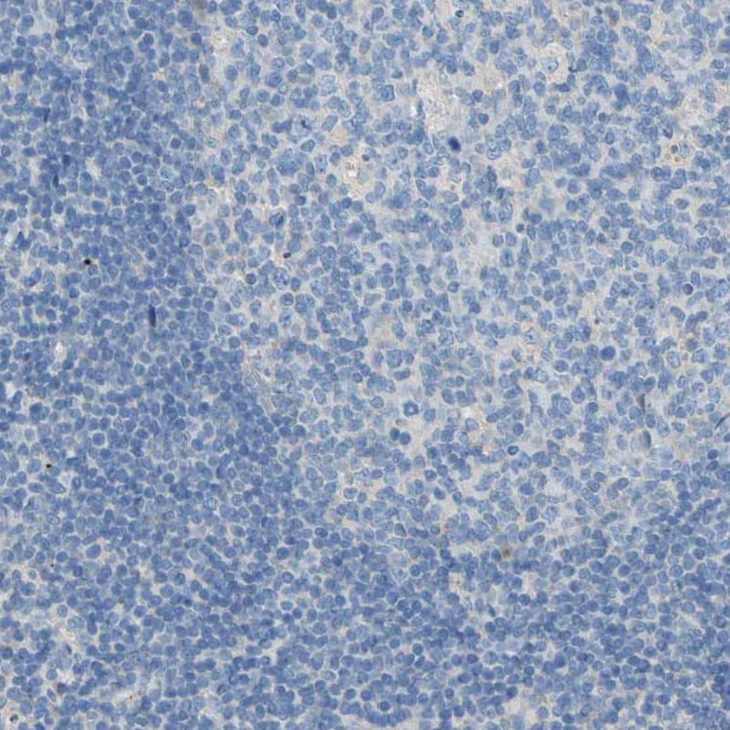 Staining of human tonsil shows no cytoplasm granular positivity in germinal center cells as expected.
