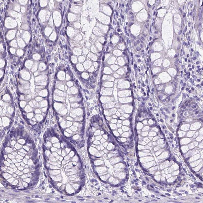 Staining of human colon shows no positivity in glandular cells as expected.