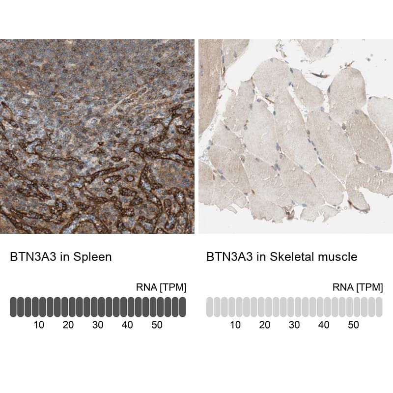 Immunohistochemistry-Paraffin BTN3A3 Antibody - BSA Free