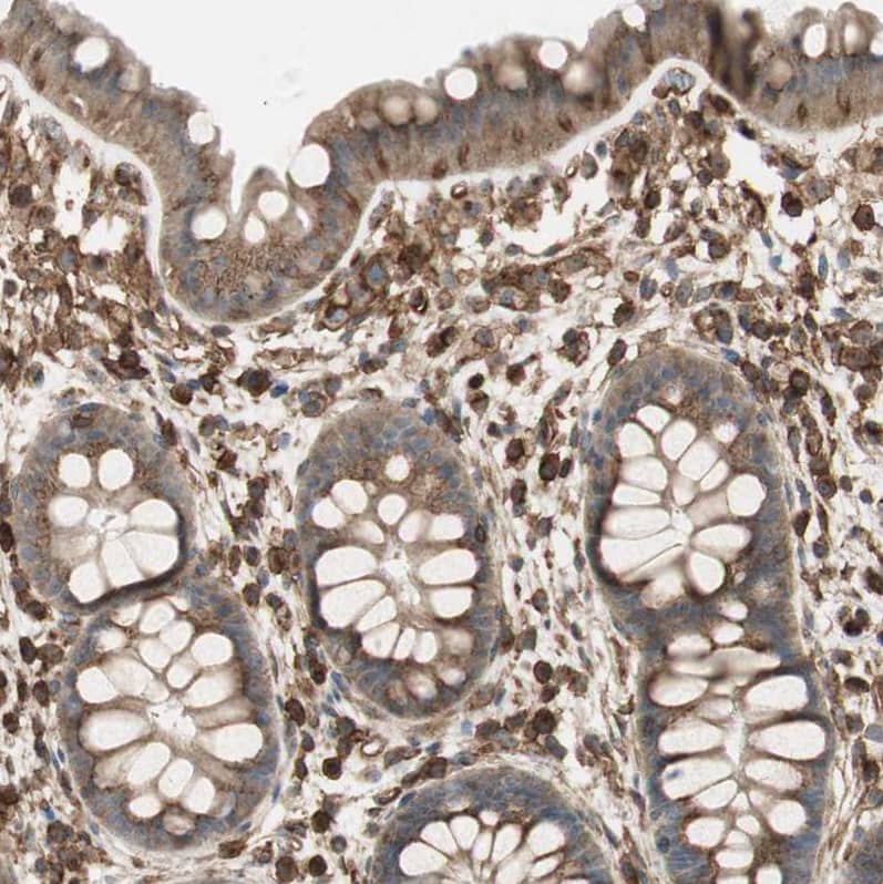 Immunohistochemistry-Paraffin BTN3A3 Antibody - BSA Free