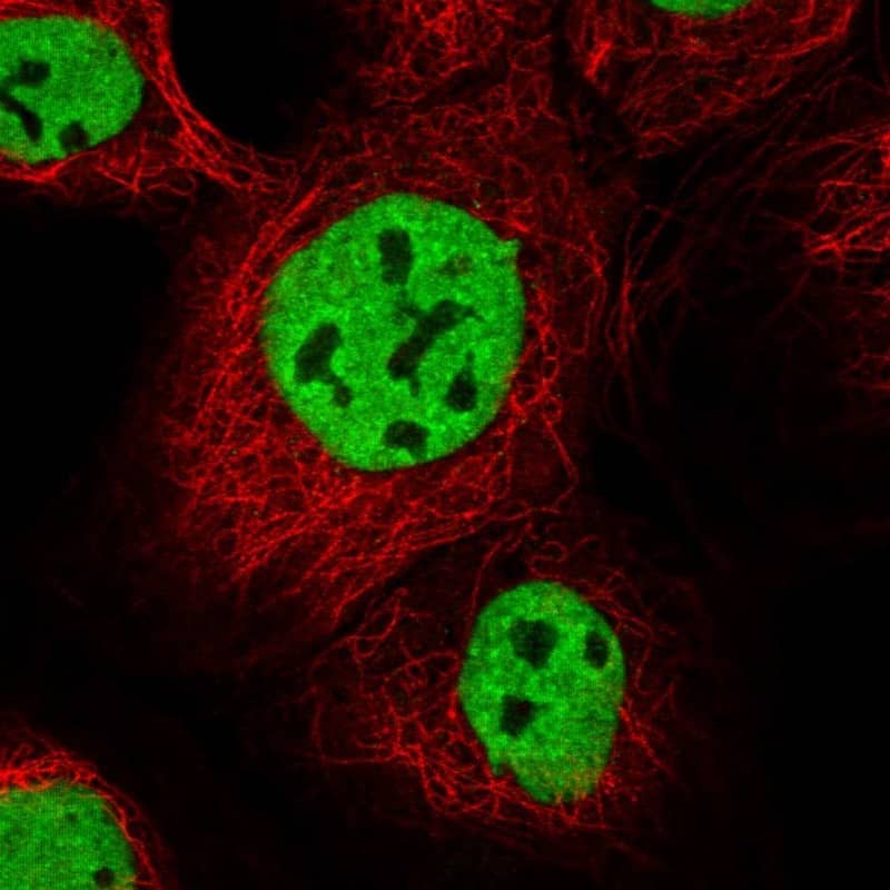 Immunocytochemistry/ Immunofluorescence IBTK Antibody - BSA Free
