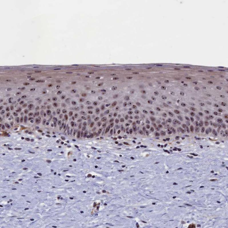 Staining of human cervix shows strong positivity in nucleoli in squamous epithelial cells.