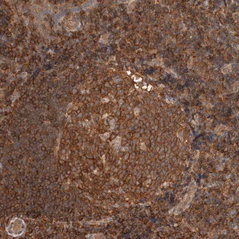 Staining of human tonsil shows strong cytoplasmic positivity in most cells.