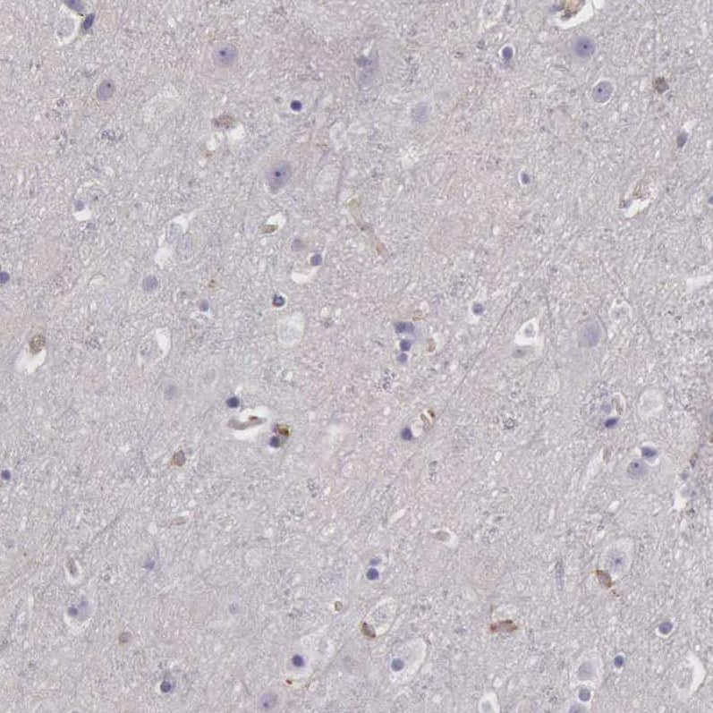 Staining of human cerebral cortex shows very weak cytoplasmic positivity in neuronal cells.