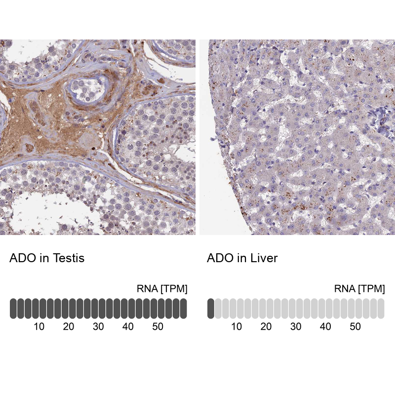Immunohistochemistry-Paraffin ADO Antibody - BSA Free