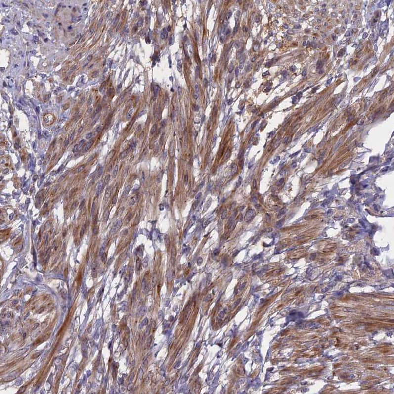 Immunohistochemistry-Paraffin ADO Antibody - BSA Free