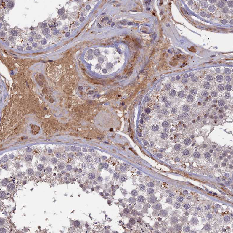 Staining of human testis shows moderate cytoplasmic positivity in Leydig cells.