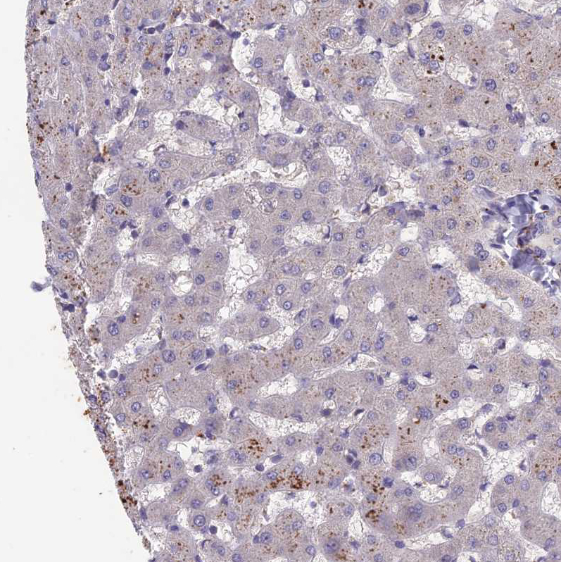 Staining of human liver shows low positivity in hepatocytes as expected.