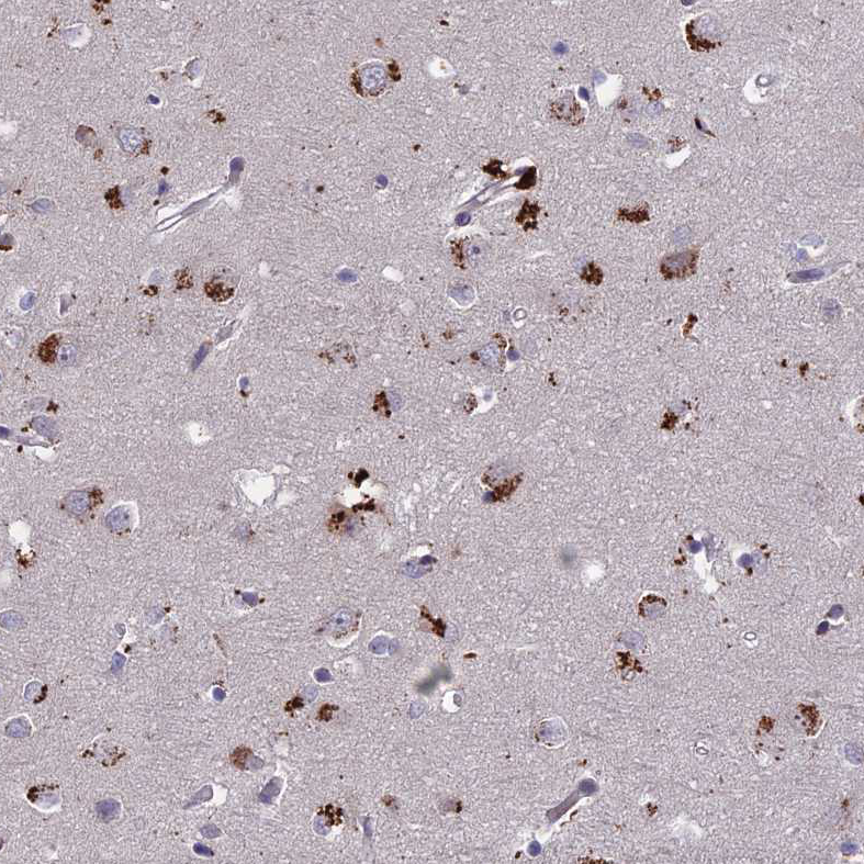 Staining of human cerebral cortex shows strong positivity in neurons.