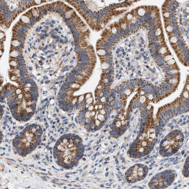Immunohistochemistry-Paraffin CCDC109A Antibody