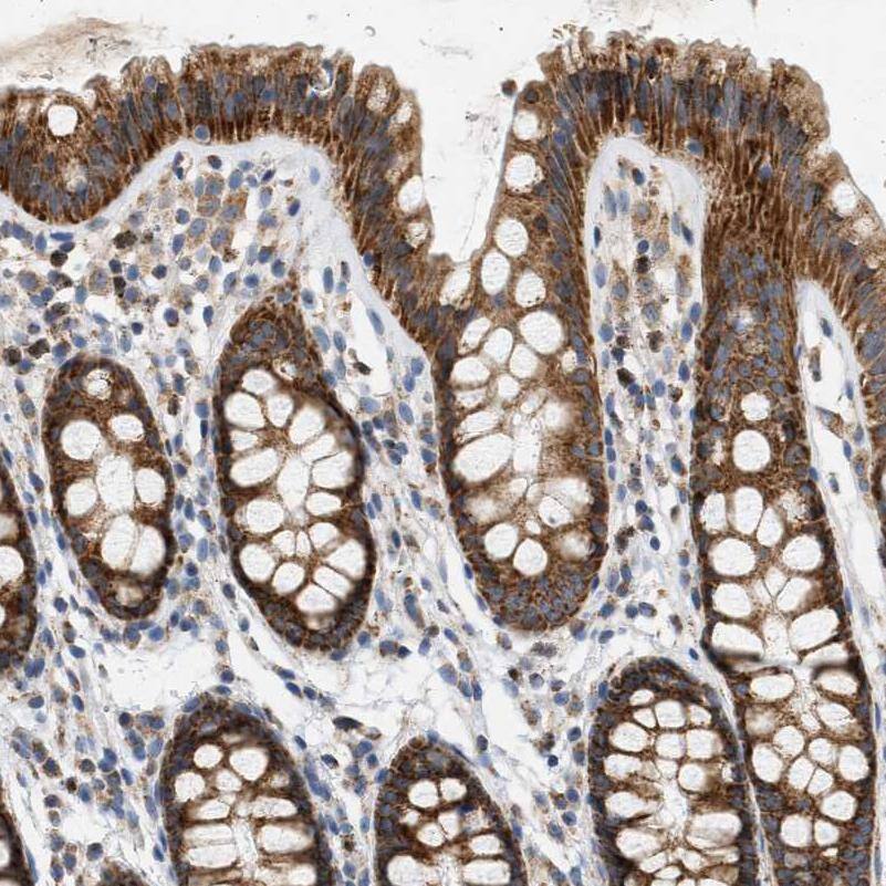 Immunohistochemistry-Paraffin CCDC109A Antibody