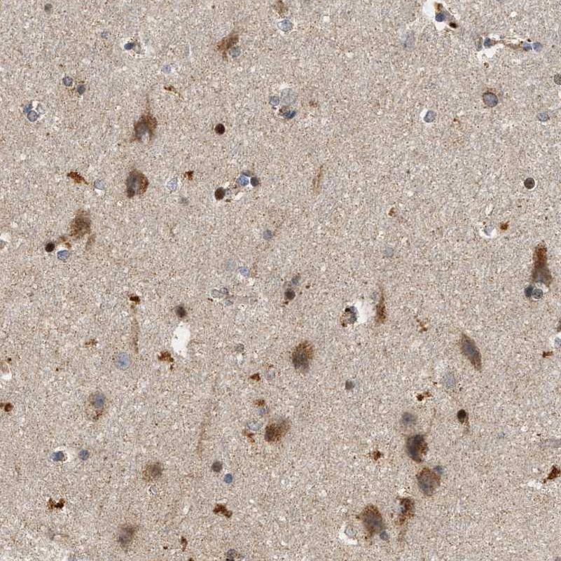 Immunohistochemistry-Paraffin CCDC109A Antibody