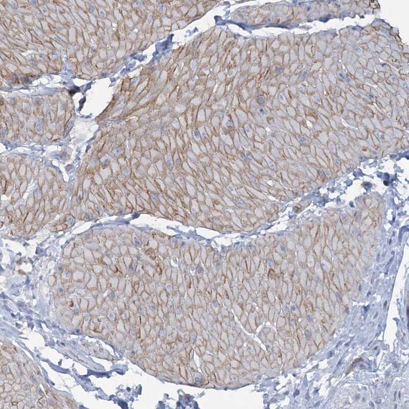 Staining of human smooth muscle shows moderate cytoplasmic positivity in smooth muscle cells.