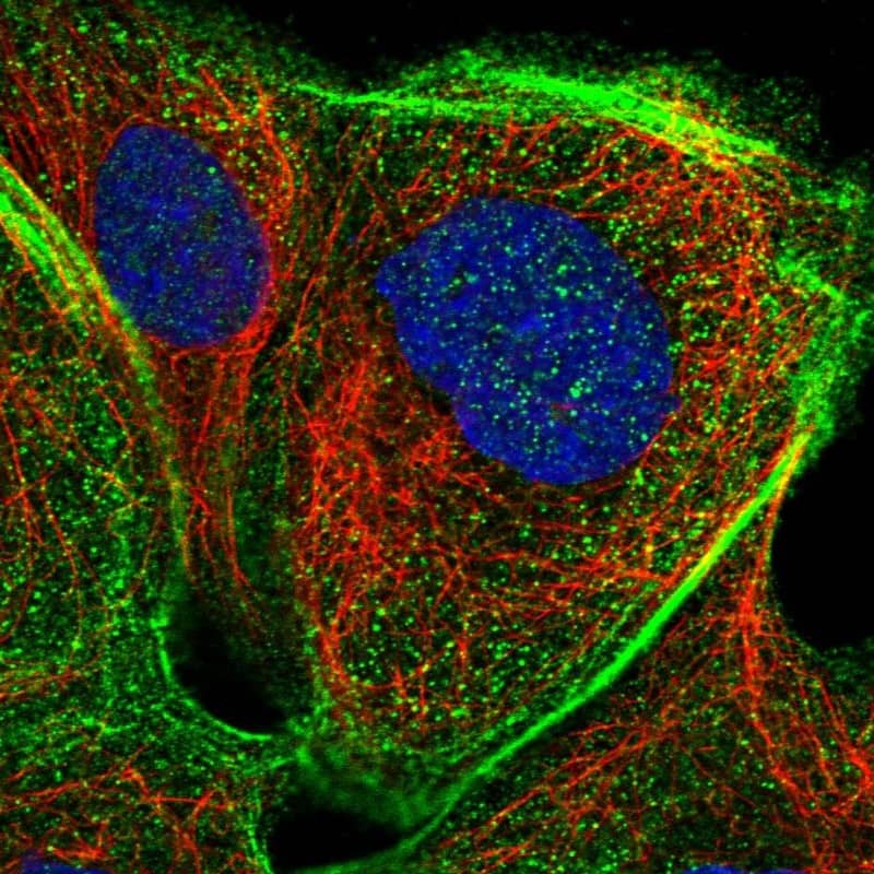 Staining of human cell line A-431 shows localization to nuclear bodies & actin filaments.