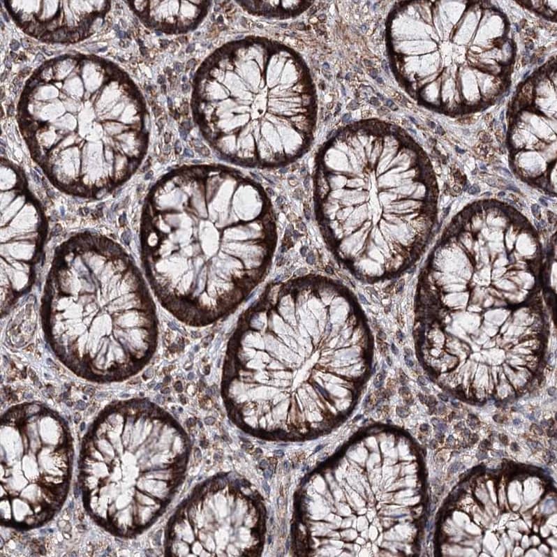 Staining of human kidney shows strong cytoplasmic positivity in cells in tubules.