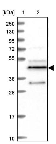 Lane 1: Marker [kDa] 250, 130, 95, 72, 55, 36, 28, 17, 10Lane 2: Human cell line RT-4