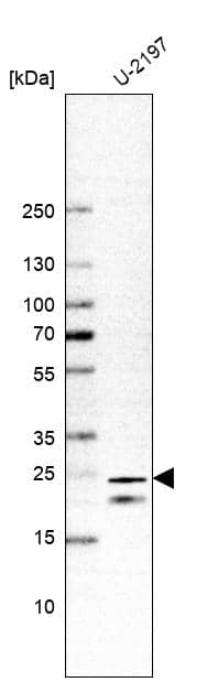 Analysis in human cell line U-2197.