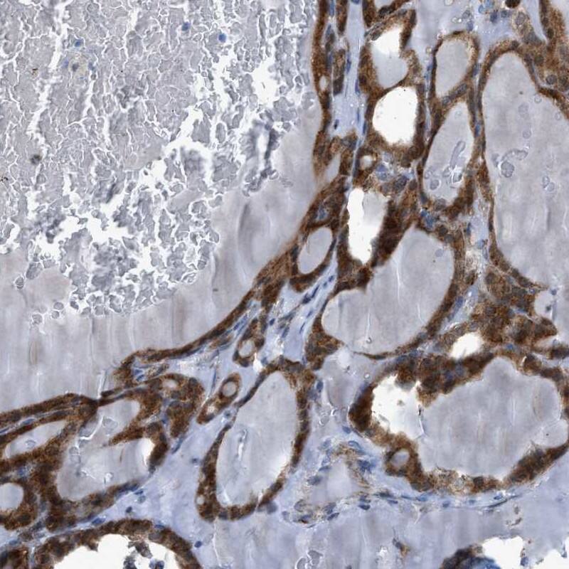 Staining of human thyroid gland shows cytoplasmic positivity in glandular cells.
