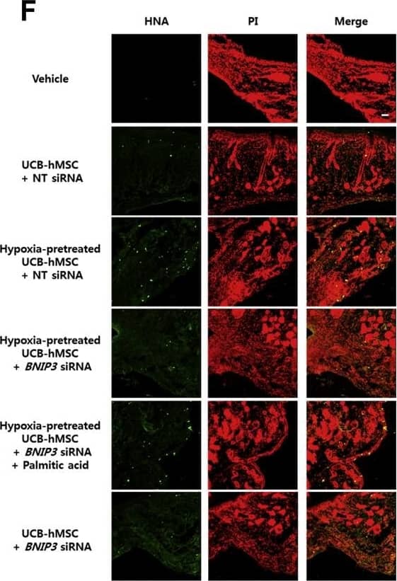 Immunocytochemistry/ Immunofluorescence: BNIP3L Antibody [NBP1-88558] - The role of PA in BNIP3 silenced UCB-hMSC survival in the mouse skin wound healing model. (A) Mouse skin wound surgery with UCB-hMSC transplantation was performed as described in Section 2. Representative gross wound images were acquired at post injection days 0, 4, 8, 12. Skin wound sizes at day 8 were compared with wound size at day 0. n = 5. (B) Tissue slide samples were stained with hematoxylin & eosin. Low & high magnified histological gross images are shown in the left & right panels, respectively. Scale bars, 260 µm (magnification, ×40) & 100 µm (magnification, ×100). n = 5. (C) Representative images of blood vessels in skin wounds on day 12 (top panel). Vessel density was analyzed by using ImageJ program (bottom panel). n = 5. (D-F) Histological tissue samples were immuno-stained with CD31,  alpha -SMA, & HNA-specific antibodies & PI for counterstaining.  alpha -SMA & HNA-positive cells were visualized by confocal microscopy. The number of CD31 &  alpha -SMA-positive cells in high power field (HPF), & the percentage of HNA-positive cells in total cells were analyzed by using Metamorph software. Scale bars, 100 µm (magnification, ×100). n = 5. Data are presented as a mean ± S.E.M. $p < 0.05 versus vehicle group, *p < 0.05 versus UCB-hMSC group given NT siRNA, #p < 0.05 versus UCB-hMSC group given NT siRNA with hypoxia pretreatment, @p < 0.05 versus UCB-hMSC group given BNIP3 siRNA with hypoxia pretreatment. Image collected & cropped by CiteAb from the following publication (//linkinghub.elsevier.com/retrieve/pii/S2213231717303804), licensed under a CC-BY license. Not internally tested by Novus Biologicals.