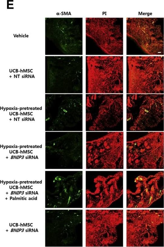 Immunocytochemistry/ Immunofluorescence: BNIP3L Antibody [NBP1-88558] - The role of PA in BNIP3 silenced UCB-hMSC survival in the mouse skin wound healing model. (A) Mouse skin wound surgery with UCB-hMSC transplantation was performed as described in Section 2. Representative gross wound images were acquired at post injection days 0, 4, 8, 12. Skin wound sizes at day 8 were compared with wound size at day 0. n = 5. (B) Tissue slide samples were stained with hematoxylin & eosin. Low & high magnified histological gross images are shown in the left & right panels, respectively. Scale bars, 260 µm (magnification, ×40) & 100 µm (magnification, ×100). n = 5. (C) Representative images of blood vessels in skin wounds on day 12 (top panel). Vessel density was analyzed by using ImageJ program (bottom panel). n = 5. (D-F) Histological tissue samples were immuno-stained with CD31,  alpha -SMA, & HNA-specific antibodies & PI for counterstaining.  alpha -SMA & HNA-positive cells were visualized by confocal microscopy. The number of CD31 &  alpha -SMA-positive cells in high power field (HPF), & the percentage of HNA-positive cells in total cells were analyzed by using Metamorph software. Scale bars, 100 µm (magnification, ×100). n = 5. Data are presented as a mean ± S.E.M. $p < 0.05 versus vehicle group, *p < 0.05 versus UCB-hMSC group given NT siRNA, #p < 0.05 versus UCB-hMSC group given NT siRNA with hypoxia pretreatment, @p < 0.05 versus UCB-hMSC group given BNIP3 siRNA with hypoxia pretreatment. Image collected & cropped by CiteAb from the following publication (//linkinghub.elsevier.com/retrieve/pii/S2213231717303804), licensed under a CC-BY license. Not internally tested by Novus Biologicals.