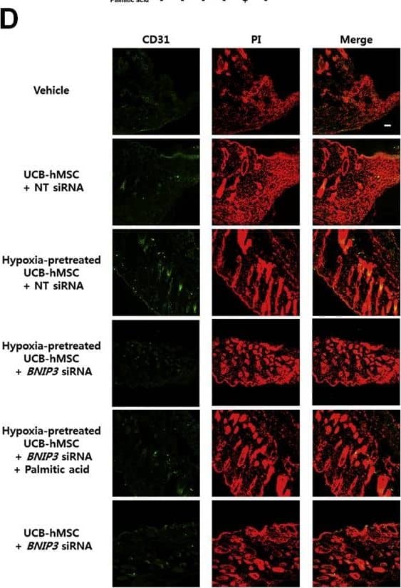 Immunocytochemistry/ Immunofluorescence: BNIP3L Antibody [NBP1-88558] - The role of PA in BNIP3 silenced UCB-hMSC survival in the mouse skin wound healing model. (A) Mouse skin wound surgery with UCB-hMSC transplantation was performed as described in Section 2. Representative gross wound images were acquired at post injection days 0, 4, 8, 12. Skin wound sizes at day 8 were compared with wound size at day 0. n = 5. (B) Tissue slide samples were stained with hematoxylin & eosin. Low & high magnified histological gross images are shown in the left & right panels, respectively. Scale bars, 260 µm (magnification, ×40) & 100 µm (magnification, ×100). n = 5. (C) Representative images of blood vessels in skin wounds on day 12 (top panel). Vessel density was analyzed by using ImageJ program (bottom panel). n = 5. (D-F) Histological tissue samples were immuno-stained with CD31,  alpha -SMA, & HNA-specific antibodies & PI for counterstaining.  alpha -SMA & HNA-positive cells were visualized by confocal microscopy. The number of CD31 &  alpha -SMA-positive cells in high power field (HPF), & the percentage of HNA-positive cells in total cells were analyzed by using Metamorph software. Scale bars, 100 µm (magnification, ×100). n = 5. Data are presented as a mean ± S.E.M. $p < 0.05 versus vehicle group, *p < 0.05 versus UCB-hMSC group given NT siRNA, #p < 0.05 versus UCB-hMSC group given NT siRNA with hypoxia pretreatment, @p < 0.05 versus UCB-hMSC group given BNIP3 siRNA with hypoxia pretreatment. Image collected & cropped by CiteAb from the following publication (//linkinghub.elsevier.com/retrieve/pii/S2213231717303804), licensed under a CC-BY license. Not internally tested by Novus Biologicals.