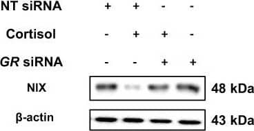 Western Blot: BNIP3L Antibody [NBP1-88558] - GR-dependent downregulation of NIX expression via PGC1 alpha .a, b Nontargeting (NT) or GR siRNA was transfected to hippocampal neurons & SH-SY5Y cells for 24 h prior to corticosterone & cortisol for 24 h, respectively. NIX expression was detected in western blot where  beta -actin was used as a loading control. n = 5. c SH-SY5Y cells were incubated with cortisol for 6 h. The mRNA expression levels of genes associated with nuclear receptors & coregulators were assessed by RT2 Profiler PCR array. Heat maps with hierarchical clustering were acquired by using the GeneGlobe Data analysis Center on Qiagen website. n = 3. d A thousand base pair upstream of the first codon of the PPARGC1A was described & the putative GRE binding sequence was emphasized with yellow labeling. e SH-SY5Y cells were incubated with cortisol for 6 h. DNA was immunoprecipitated with IgG, RNA polymerase (RNAPol), & glucocorticoid receptor (GR) antibody. The immunoprecipitation & input samples were amplified with primers of GAPDH & PPARGC1A gene. n = 5. All blots are representative. n = 3 or 5 from independent experiments with two technical replicates each, respectively. Quantitative data are presented as a mean ± S.E.M. Two-sided two-way ANOVA was conducted in Fig. 6a, b. Two-sided unpaired student’s t test was conducted in Fig. 6e. ** indicates p < 0.01 versus control. ## indicates p < 0.01 versus corticosterone in hippocampal neurons & cortisol in SH-SY5Y, respectively. Data are provided as a Source data file. Image collected & cropped by CiteAb from the following publication (//pubmed.ncbi.nlm.nih.gov/33473105), licensed under a CC-BY license. Not internally tested by Novus Biologicals.