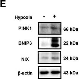 Western Blot: BNIP3L Antibody [NBP1-88558] - Effects of hypoxia on mitophagy regulator expressions & mitophagy in UCB-hMSCs. (A) UCB-hMSCs incubated w/ various times of hypoxia (0–48 h). Cells stained w/ Mitotracker™. n = 6 (magnification, ×1,200). Scale bars, 50 µm. (B) The expressions of COX4 &  beta -actin detected by western blot. n = 4. (C) UCB-hMSCs exposed to 24 h of normoxia or hypoxia. Cells immuno-stained w/ COX4 & LC3B-specific antibodies (magnification, ×600). Scale bars, 37.5 µm. (D) The mRNA expressions of PINK1, BNIP3, NIX & FUNDC1 analyzed by quantitative real-time PCR (qPCR). n = 5. (E) The protein expressions of PINK1, BNIP3, NIX &  beta -actin assessed by western blot. n = 4. (F, G) siRNAs of PINK1, BNIP3, NIX or non-targeting (NT) transfected to UCB-hMSCs prior to hypoxia treatment for 24 h. COX4 &  beta -actin expressions assessed by western blot. n = 4 (F). Cells immunostained w/ COX4 & PI. n = 3 (magnification, ×400). All scale bars, 50 µm. COX4 fluorescence intensity analyzed by luminometer. n = 5 (G). (H) BNIP3 siRNA transfected to UCB-hMSCs prior to hypoxia treatment for 24 h. Cells stained w/ Mitotracker™. n = 6 (magnification, ×1,200). Scale bars, 50 µm. (I) BNIP3,  beta -tubulin & COX4 w/ cytosol & mitochondrial fractionized samples detected by western blot. (J) Cells incubated w/ hypoxia or normoxia for 24 h. Cells immuno-stained w/ BNIP3 & LC3B-specific antibodies. (magnification, ×600). Scale bars, 37.5 µm. Western blot data normalized by  beta -actin, & qPCR data normalized by ACTB mRNA expression level. Quantitative data are presented as a mean ± S.E.M. All blot & confocal images are representative. *p < 0.05 versus control, #p < 0.05 versus hypoxia. Image collected & cropped by CiteAb from the following publication (//linkinghub.elsevier.com/retrieve/pii/S2213231717303804), licensed under a CC-BY license. Not internally tested by Novus Biologicals.