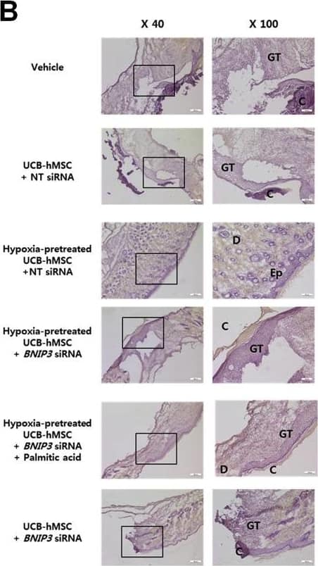 Immunocytochemistry/ Immunofluorescence: BNIP3L Antibody [NBP1-88558] - The role of PA in BNIP3 silenced UCB-hMSC survival in the mouse skin wound healing model. (A) Mouse skin wound surgery with UCB-hMSC transplantation was performed as described in Section 2. Representative gross wound images were acquired at post injection days 0, 4, 8, 12. Skin wound sizes at day 8 were compared with wound size at day 0. n = 5. (B) Tissue slide samples were stained with hematoxylin & eosin. Low & high magnified histological gross images are shown in the left & right panels, respectively. Scale bars, 260 µm (magnification, ×40) & 100 µm (magnification, ×100). n = 5. (C) Representative images of blood vessels in skin wounds on day 12 (top panel). Vessel density was analyzed by using ImageJ program (bottom panel). n = 5. (D-F) Histological tissue samples were immuno-stained with CD31,  alpha -SMA, & HNA-specific antibodies & PI for counterstaining.  alpha -SMA & HNA-positive cells were visualized by confocal microscopy. The number of CD31 &  alpha -SMA-positive cells in high power field (HPF), & the percentage of HNA-positive cells in total cells were analyzed by using Metamorph software. Scale bars, 100 µm (magnification, ×100). n = 5. Data are presented as a mean ± S.E.M. $p < 0.05 versus vehicle group, *p < 0.05 versus UCB-hMSC group given NT siRNA, #p < 0.05 versus UCB-hMSC group given NT siRNA with hypoxia pretreatment, @p < 0.05 versus UCB-hMSC group given BNIP3 siRNA with hypoxia pretreatment. Image collected & cropped by CiteAb from the following publication (//linkinghub.elsevier.com/retrieve/pii/S2213231717303804), licensed under a CC-BY license. Not internally tested by Novus Biologicals.