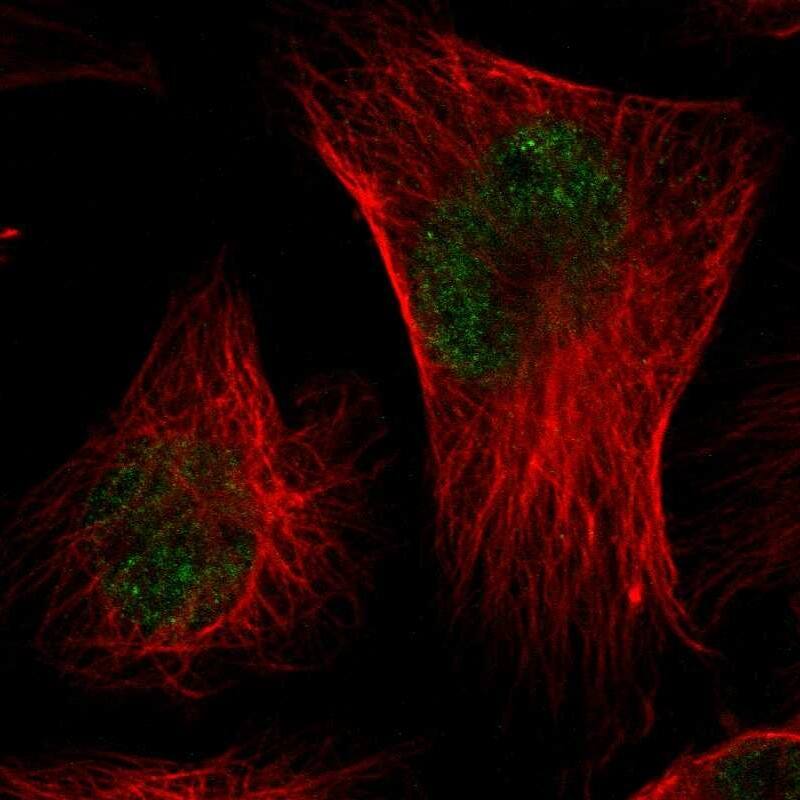 Immunocytochemistry/ Immunofluorescence CMTM3 Antibody - BSA Free