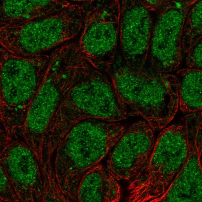 Immunocytochemistry/ Immunofluorescence BRI3BP Antibody - BSA Free