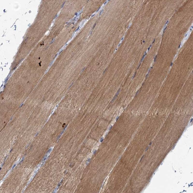 Immunohistochemistry-Paraffin MRPL51 Antibody - BSA Free