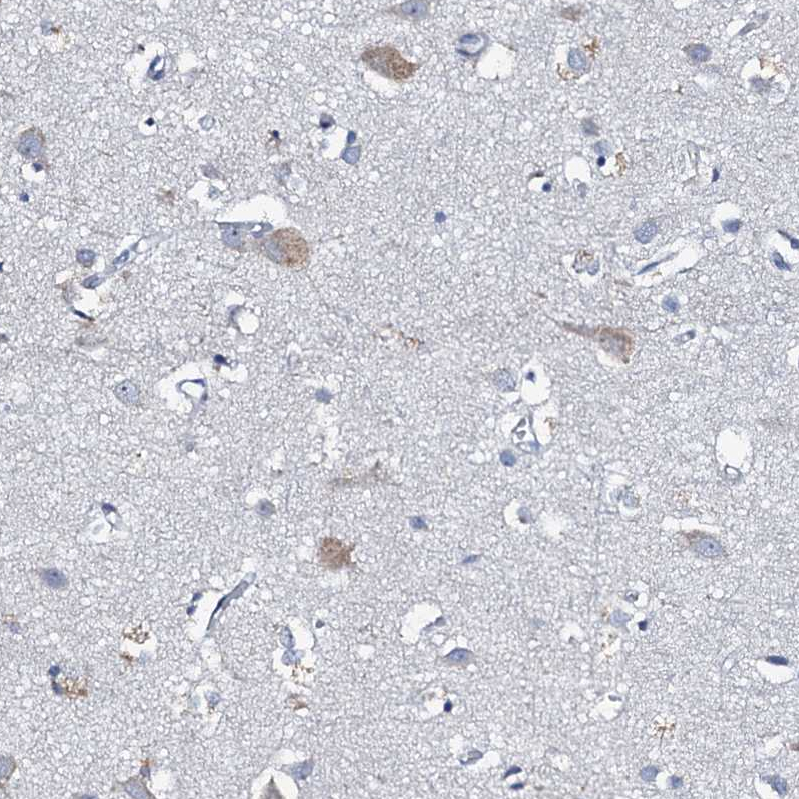 Staining of human cerebral cortex shows weak cytoplasmic positivity in neurons.