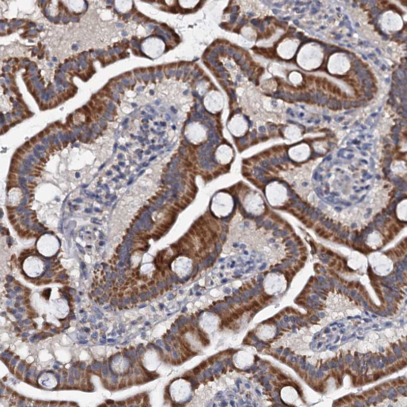 Staining of human gastrointestinal shows strong cytoplasmic positivity in glandular cells.