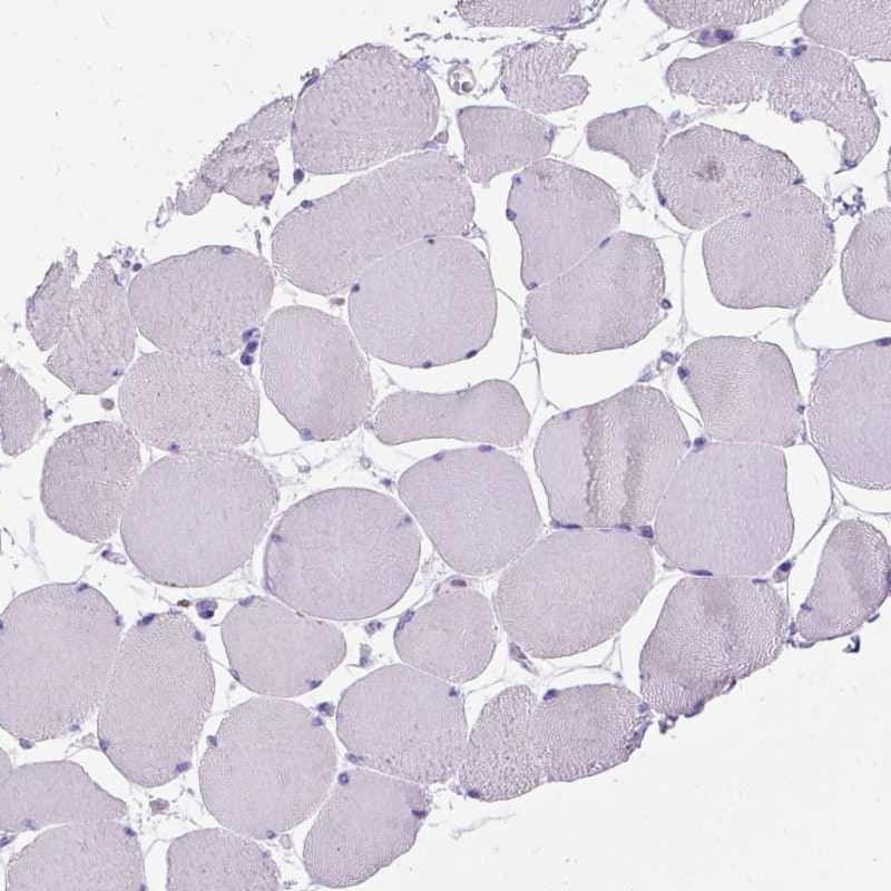 Immunohistochemistry-Paraffin MBP-1 Antibody - BSA Free