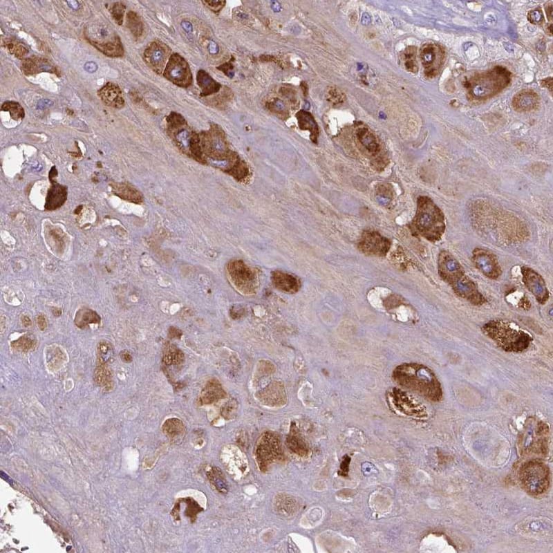 Immunohistochemistry-Paraffin MBP-1 Antibody - BSA Free