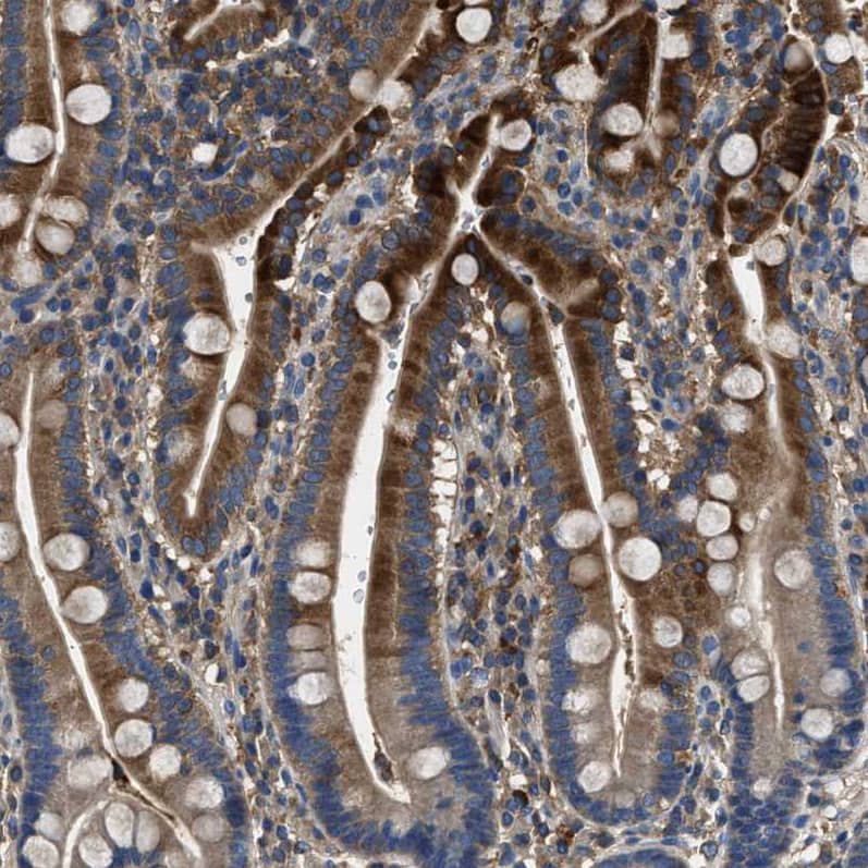 Immunohistochemistry-Paraffin BLOC1S1 Antibody