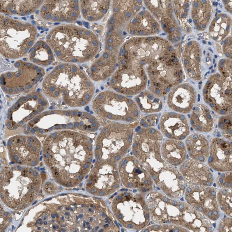 Immunohistochemistry-Paraffin BLOC1S1 Antibody