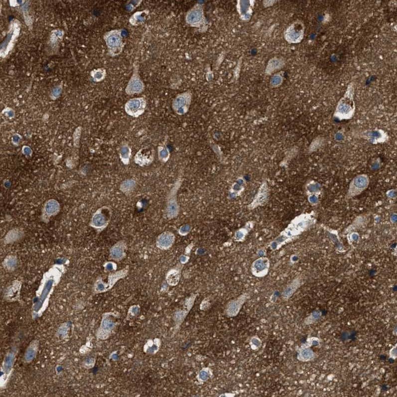 Immunohistochemistry-Paraffin BLOC1S1 Antibody