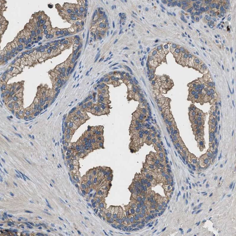 Immunohistochemistry-Paraffin BLOC1S1 Antibody
