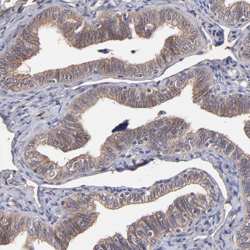<b>Orthogonal Strategies Validation. </b>Staining of human fallopian tube shows moderate cytoplasmic positivity in glandular cells.