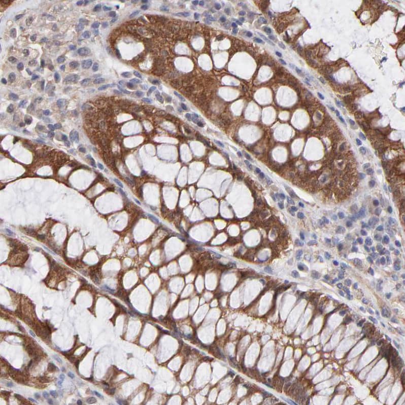 Staining of human rectum shows strong cytoplasmic positivity in glandular cells.