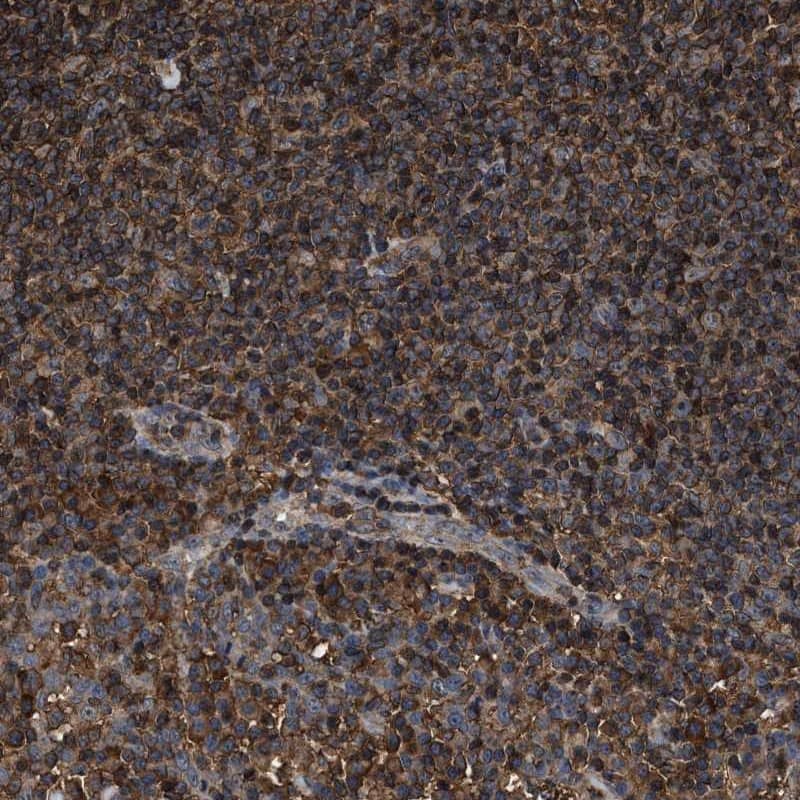 Immunohistochemistry-Paraffin KBTBD2 Antibody - BSA Free