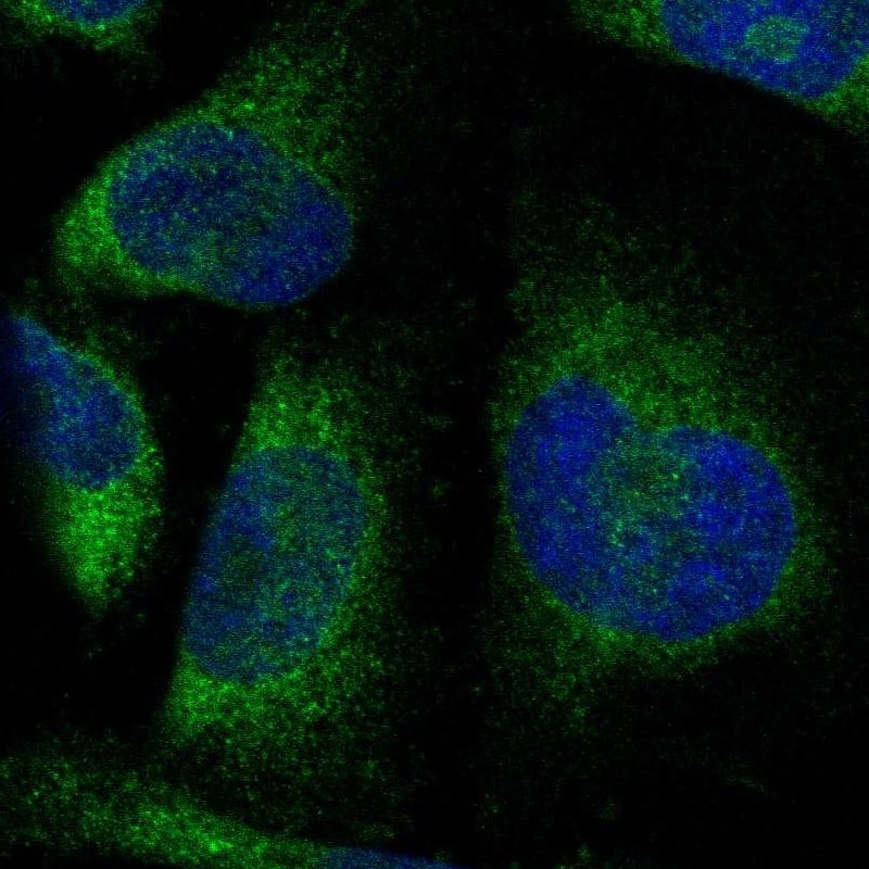 Staining of human cell line U-251 MG shows localization to endoplasmic reticulum.