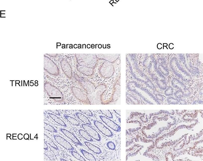 <b>Orthogonal Strategies Validation. </b>TRIM58 interacted with RECQL4 and enhanced its ubiquitination in CRC cells. A The relative mRNA levels of RECQL4 in SW620 cells transduced with RECQL4 expression vector. B The protein levels of RECQL4 in SW620 cells transduced with RECQL4 expression vector and treated with MG132. C Co-IP assay shows that TRIM58 interacted with RECQL4 in SW620 cells. D Ubiquitination assay was performed to examine the ubiquitination of RECQL4 in LOVO cells transduced with TRIM58 shRNA and SW620 cells transduced with TRIM58 expression vector. E Immunohistochemistry staining was performed to examine the protein expression of TRIM58 and RECQL4 in CRC and paracancerous tissues (scale bar, 100 μm) Image collected and cropped by CiteAb from the following open publication (//pubmed.ncbi.nlm.nih.gov/37516854), licensed under a CC-BY license. Not internally tested by Novus Biologicals.