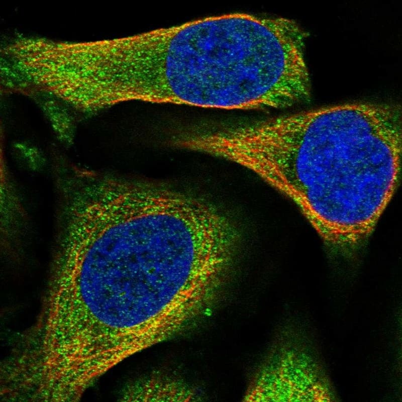 Staining of human cell line U-2 OS shows localization to cytosol.