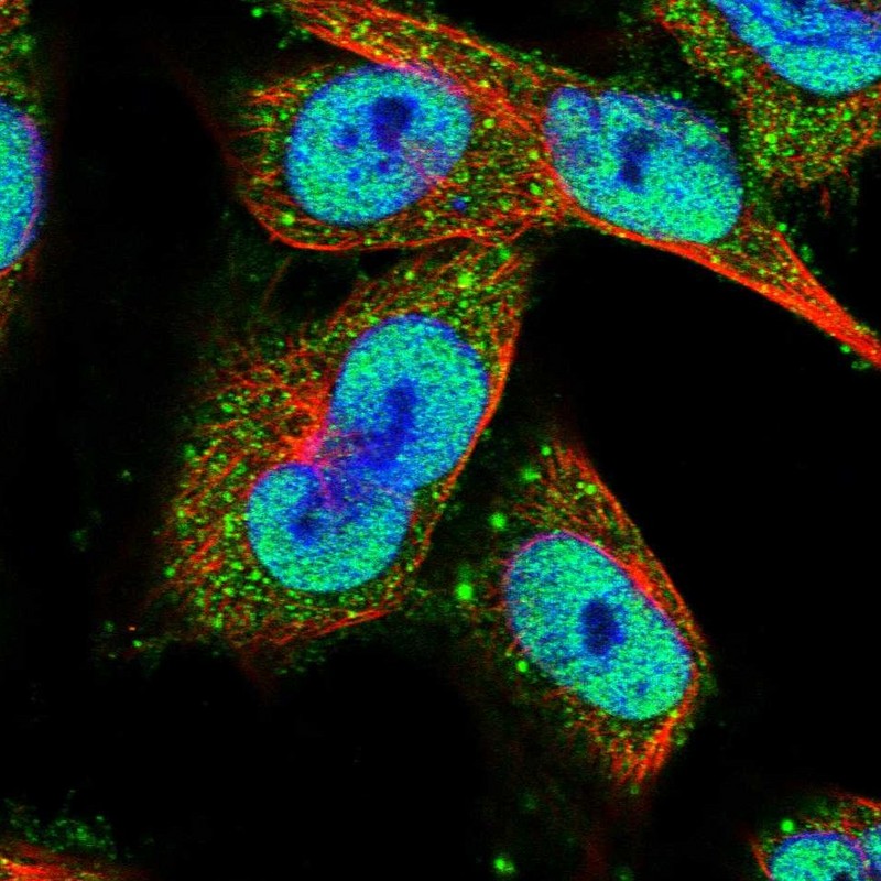 Staining of human cell line U-251 MG shows localization to nucleoplasm & vesicles.