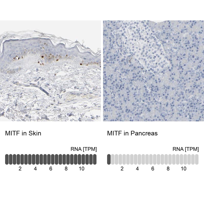 <b>Orthogonal Strategies Validation. </b>Analysis in human skin and pancreas tissues. Corresponding RNA-seq data are presented for the same tissues.